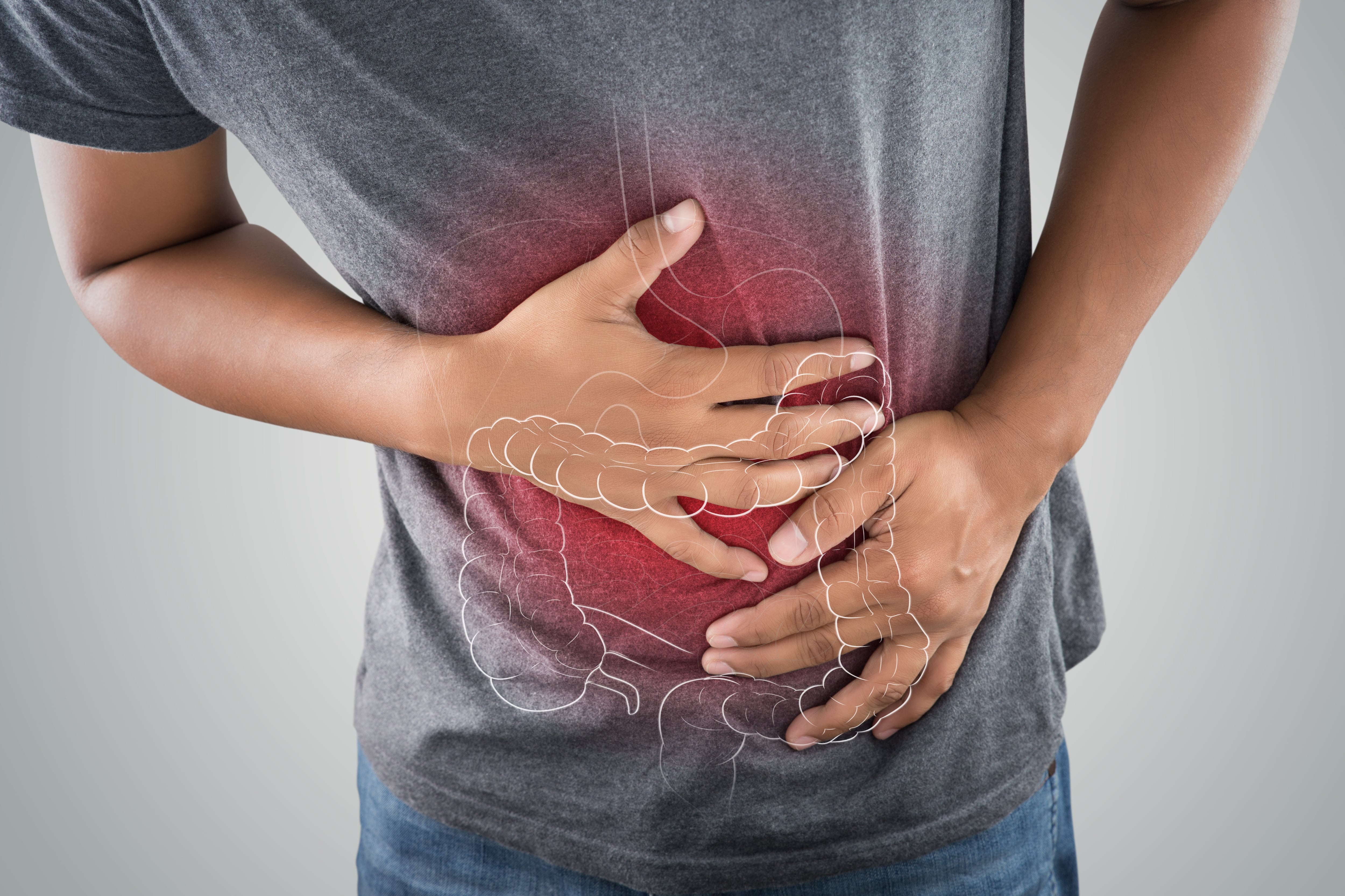 Chestnut and quebracho supplement may improve IBS symptoms